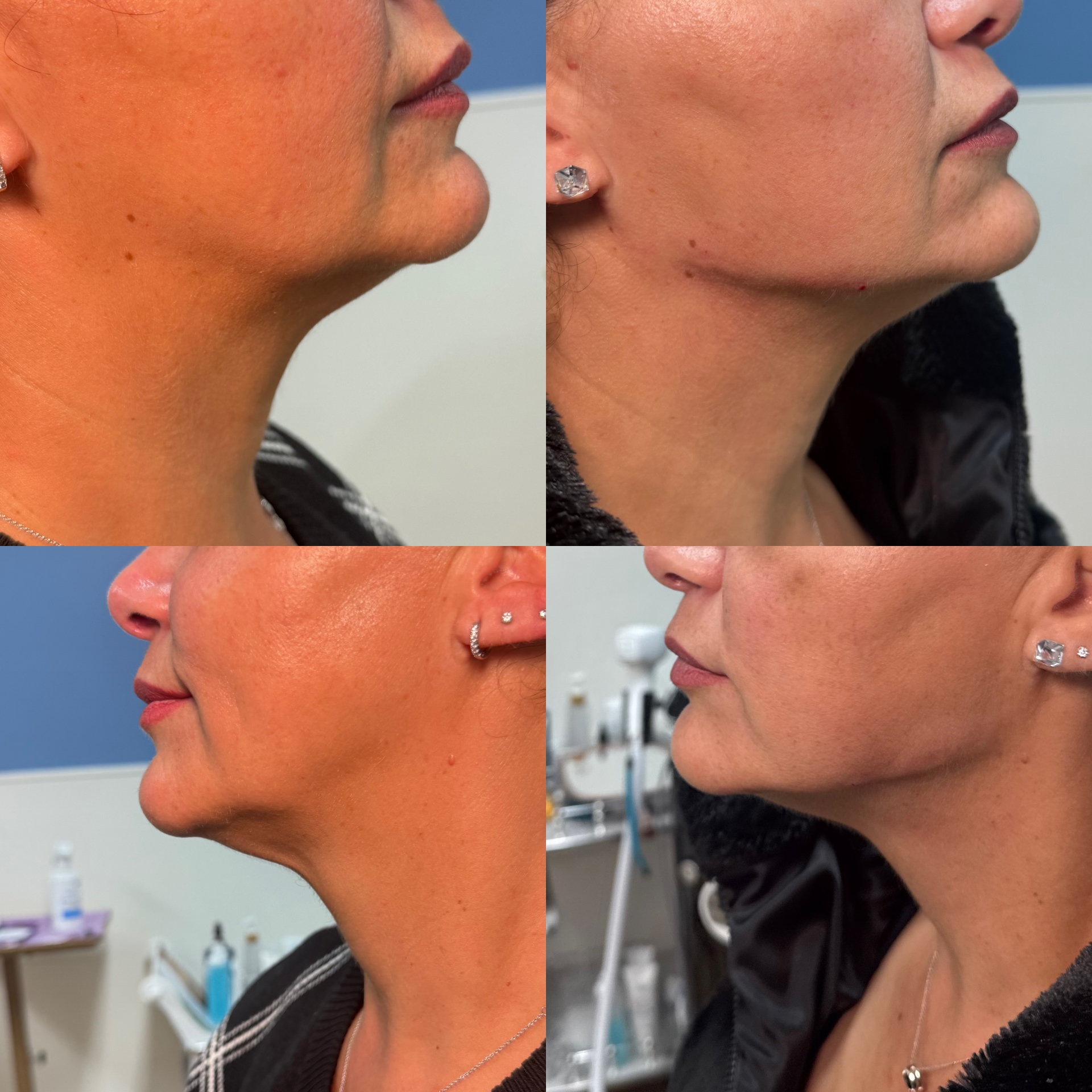 Why Eternia Medspa Is the Go-To Destination for Aesthetic Treatments
